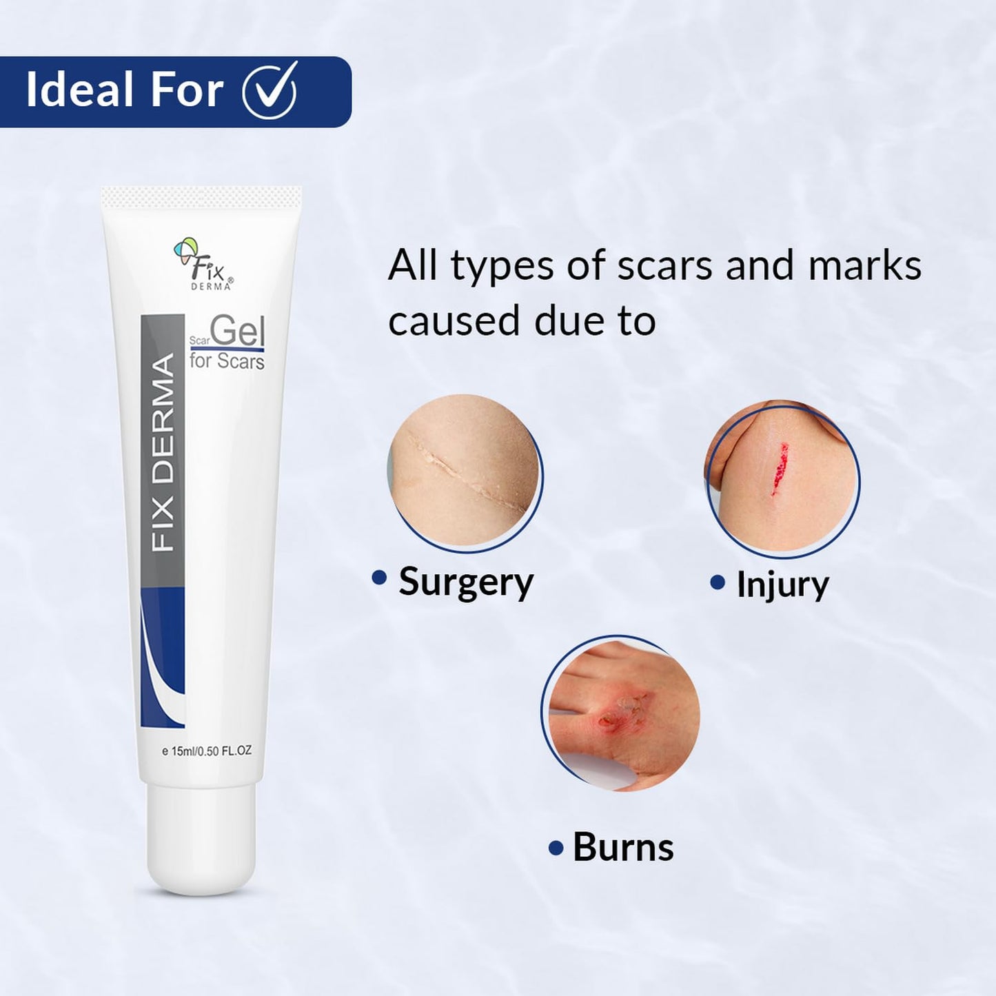 Fixderma Scar gel, Reduces Acne Scars, Surgery Scars, Injury Scars, Burn Scars, Keloid Scars, Scar Diminishing Gel, Scars due to Stretch marks, Suitable for all skin types- 15g