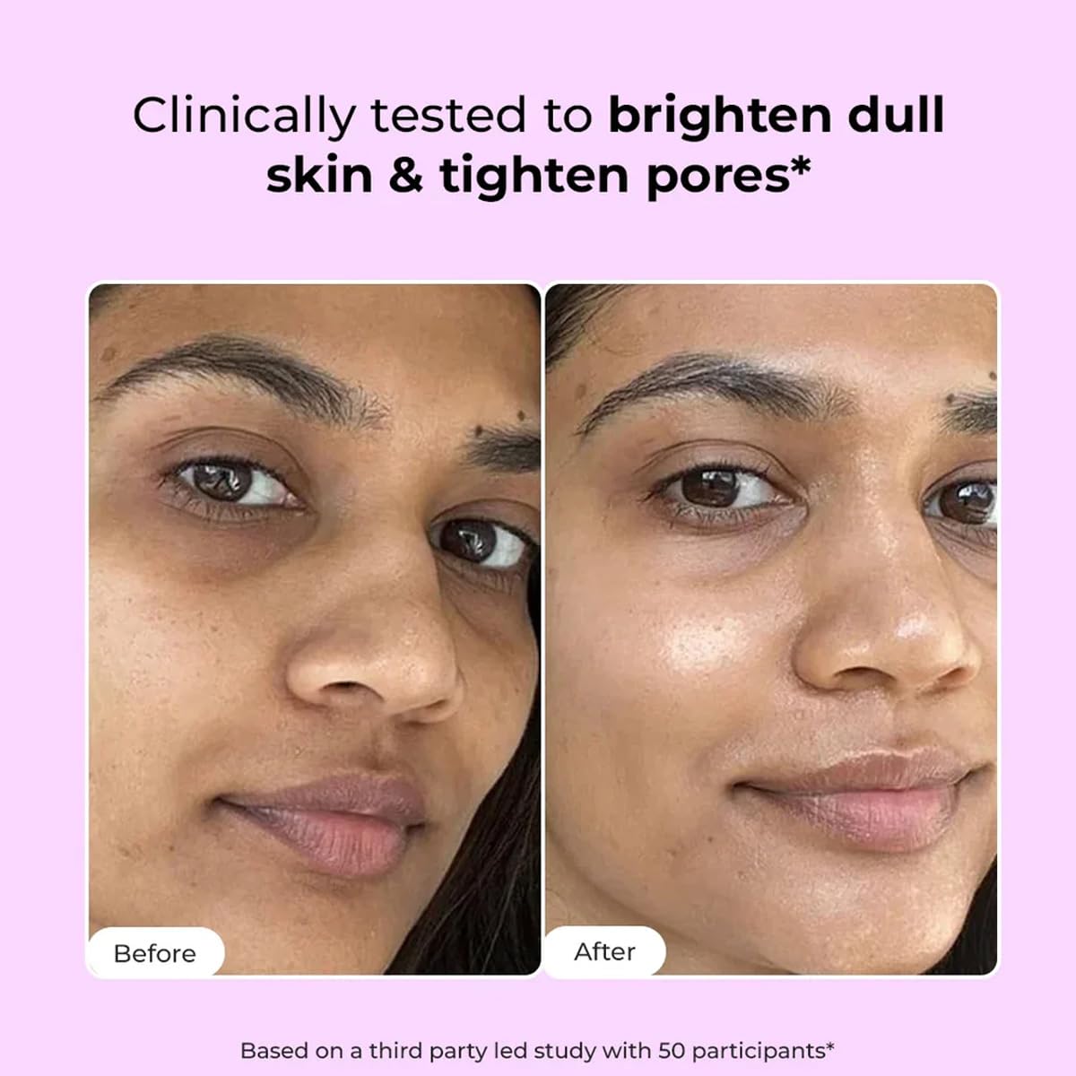 Before and after skin comparison with text on a pink background