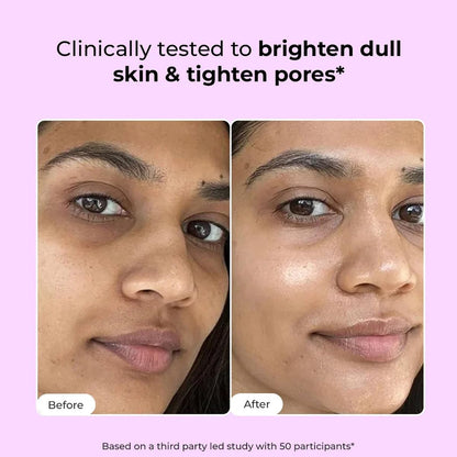 Before and after skin comparison with text on a pink background
