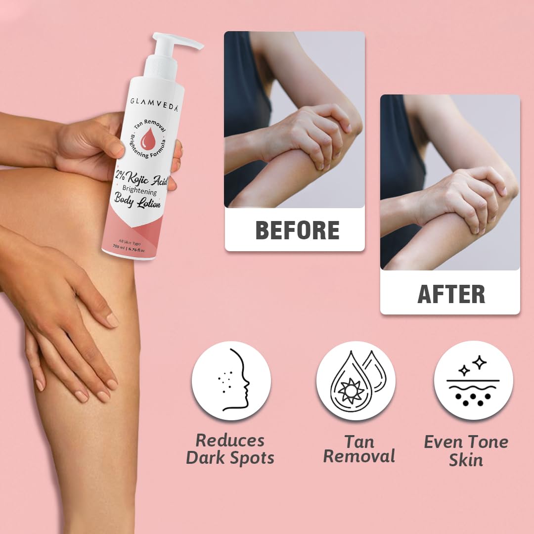 Glamveda Body Lotion with 2% Kojic Acid & Alpha Arbutin 200ml Pack of 1 | 24hr Deep Moisturizer for Dry Skin, Nourishes & Protect Skin | Remove Dark Spots, Pigmentation, Tan Removal | Non Greasy | All Skin Type