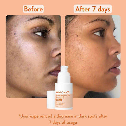 Before and after comparison of a face with dark spots, featuring WishCare cream.