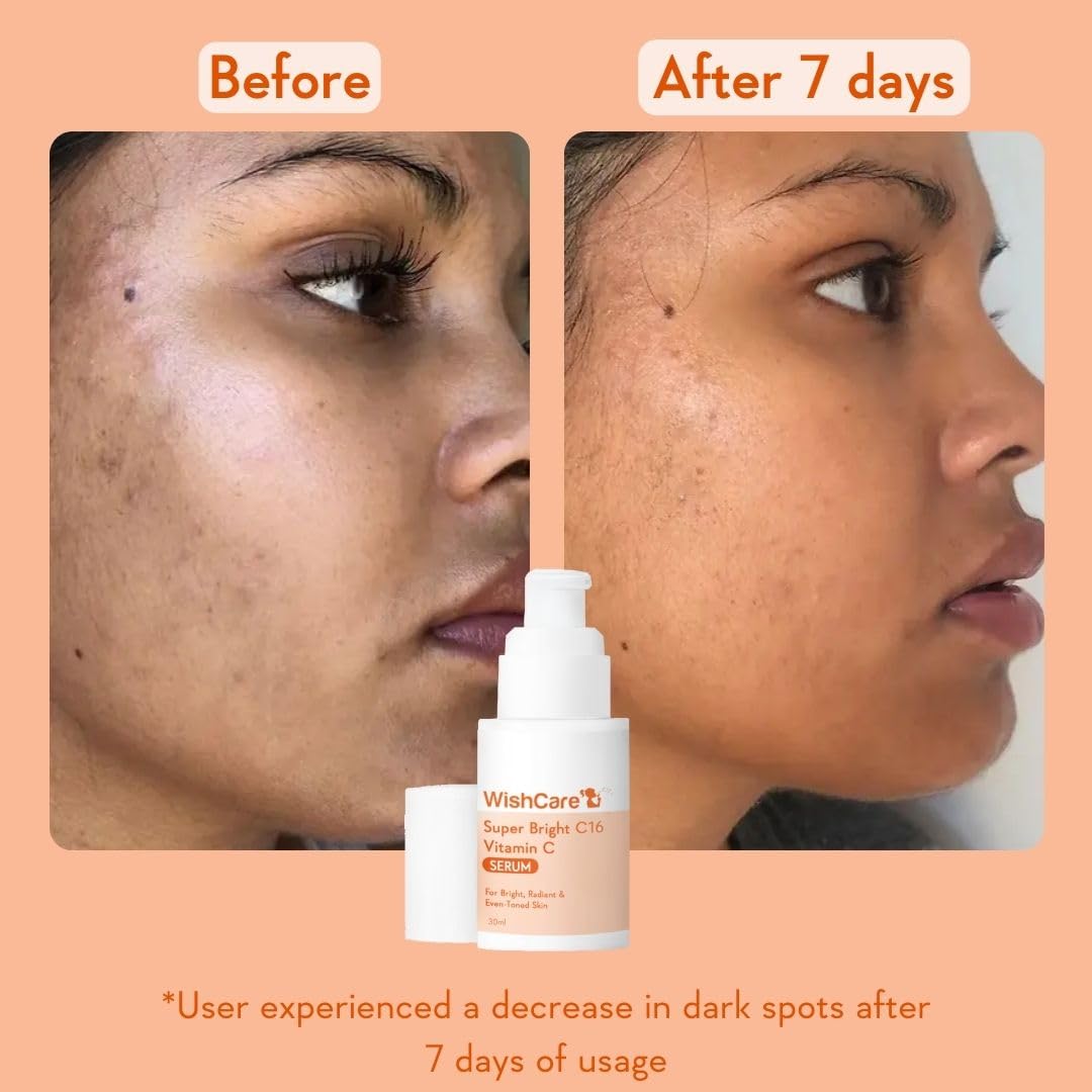 Before and after comparison of a face with dark spots, featuring WishCare cream.