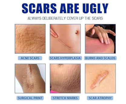 Scar Removal Cream for Skin Recovery & Scar Care | Moisturizing Formula for Smoother-Looking Skin | Helps Reduce the Appearance of Marks