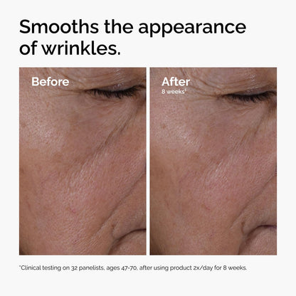 Before and after comparison of wrinkles on a person's eye area with text indicating product effectiveness.