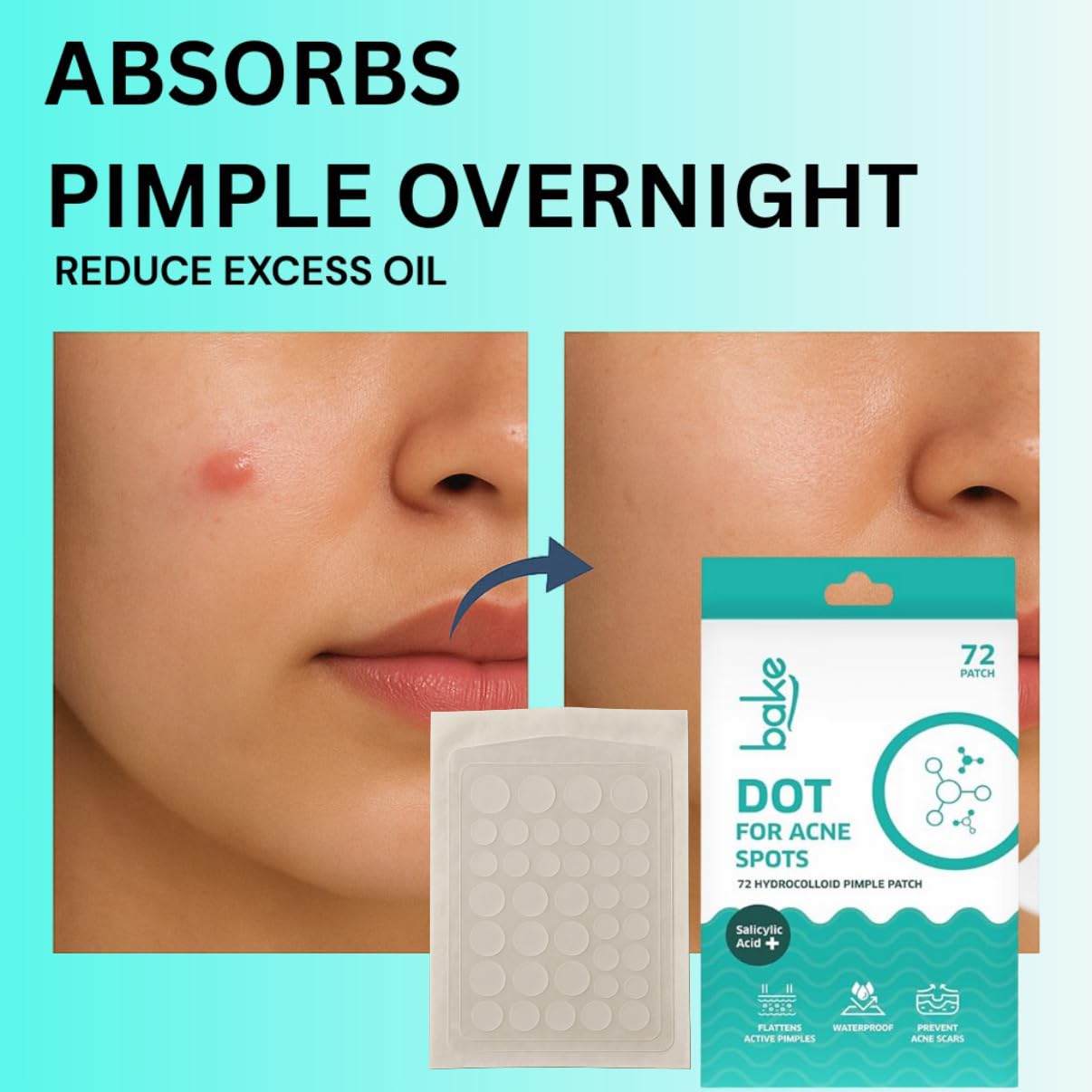 BAKE 2% Salicylic Acid Hydrocolloid Pimple Patches (36 Dots) | Absorbs Oil, Prevents Acne | Waterproof Patches | For Acne, Acne Marks, Acne Prone Skin - 36 Dots