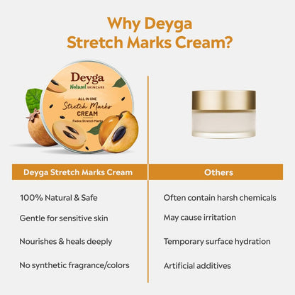 Deyga Stretch Marks Cream | Reduces Appearance of Stretch Marks | Hydrating & Nourishing | For Pregnancy, Weight Fluctuations, & Growth Spurts | 100% Natural | 100g