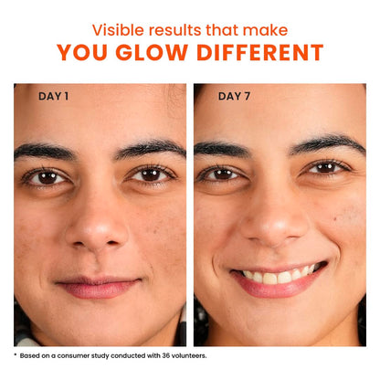 Foxtale 10% Vitamin C + Glutathione Complex Serum, Brightens skin in 3 days, Fades melasma & dark spots, Evens Skin tone, Gentle & Non-irritating, For All Skin types, Men & Women
