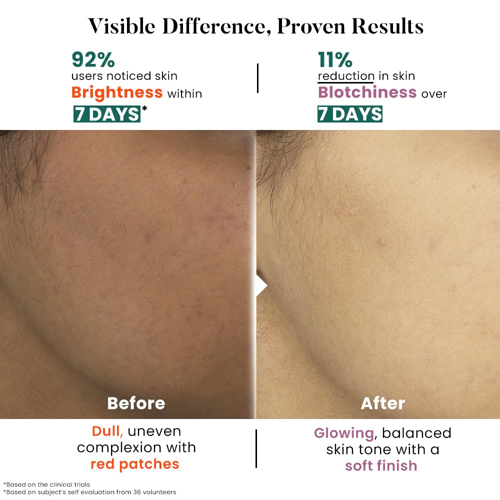 Before and after skin comparison showing brightness and blotchiness reduction with text indicating user feedback.