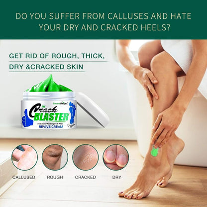 Smartdrops Foot Cream Deeply Moisturizes and Softens Feet & Elbow Skin - 50gm