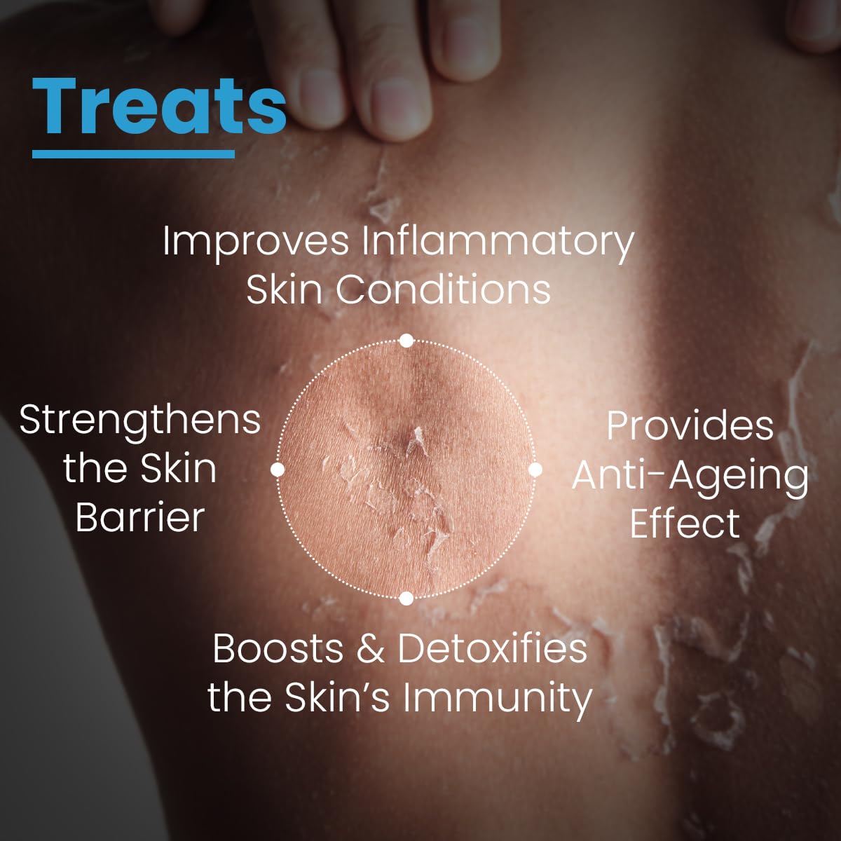 FCL Pre+Probiotic Body Lotion,W/Probiotic, Restores The Skin Barrier, Suitable For Eczema & Itch-Prone Skin, 200ml