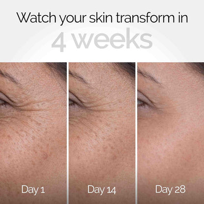 PERSONAL TOUCH SKINCARE Backshift Anti-Aging Face Cream | Youthifying Peptide, Niacinamide & 0.3% Granactive Retinoid (HPR) | Wrinkle Repair, Firming & Collagen Boost | 30ml