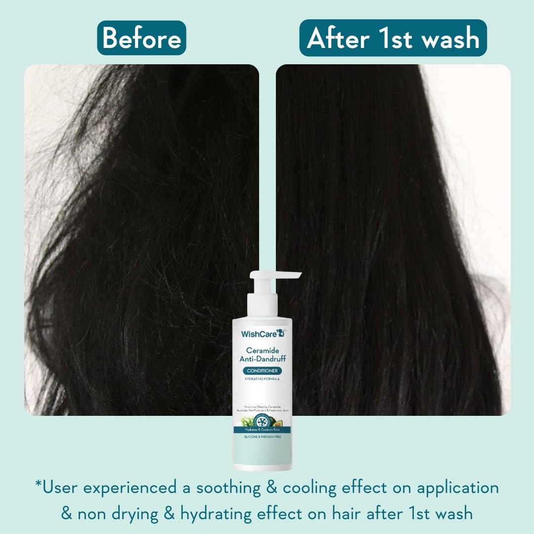 Before and after comparison of hair with a bottle of WishCare shampoo on a light blue background