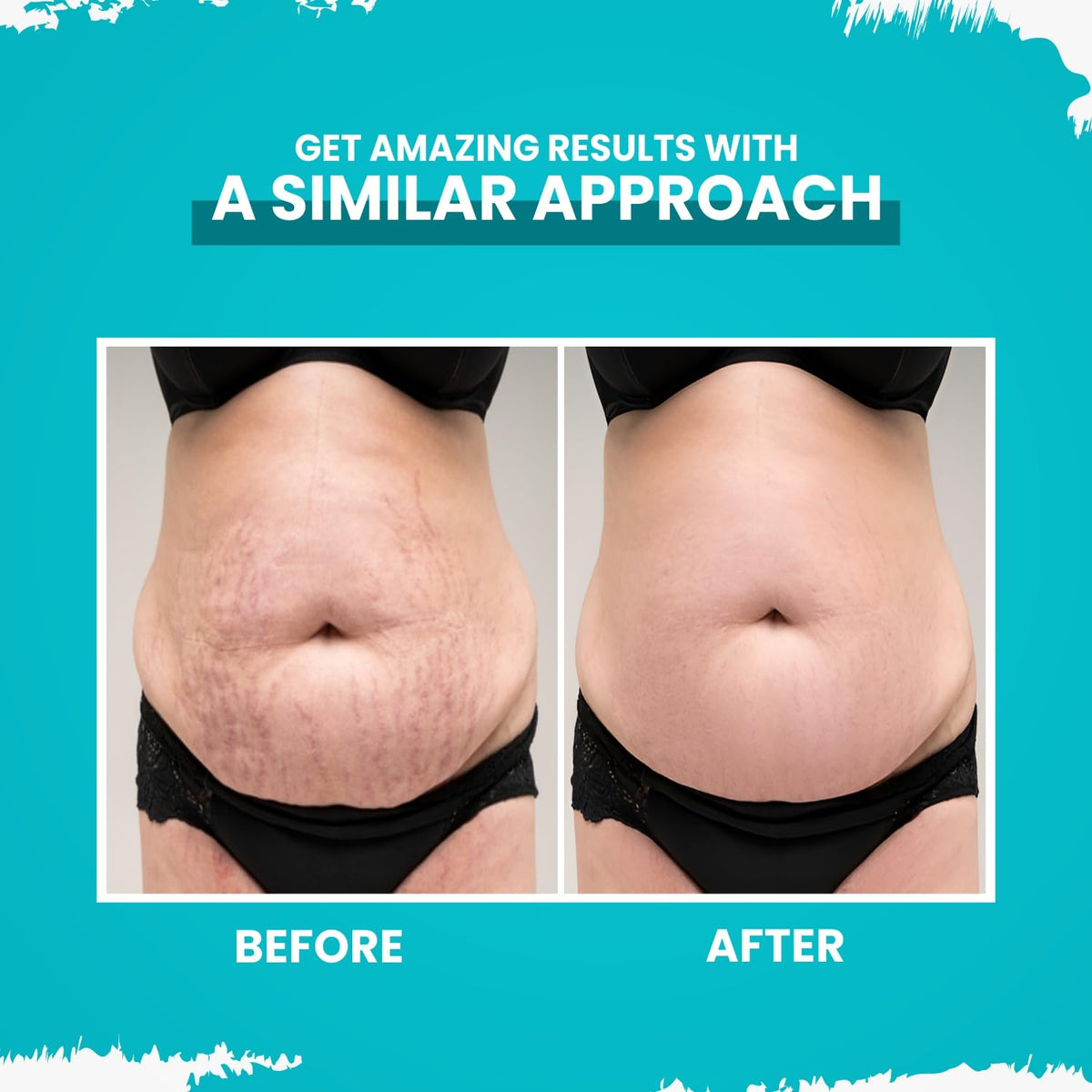 Before and after comparison of a person's waist with text on a blue background