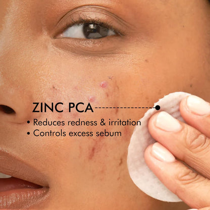 Person applying a product labeled 'ZINC PCA' to their skin with text indicating benefits.