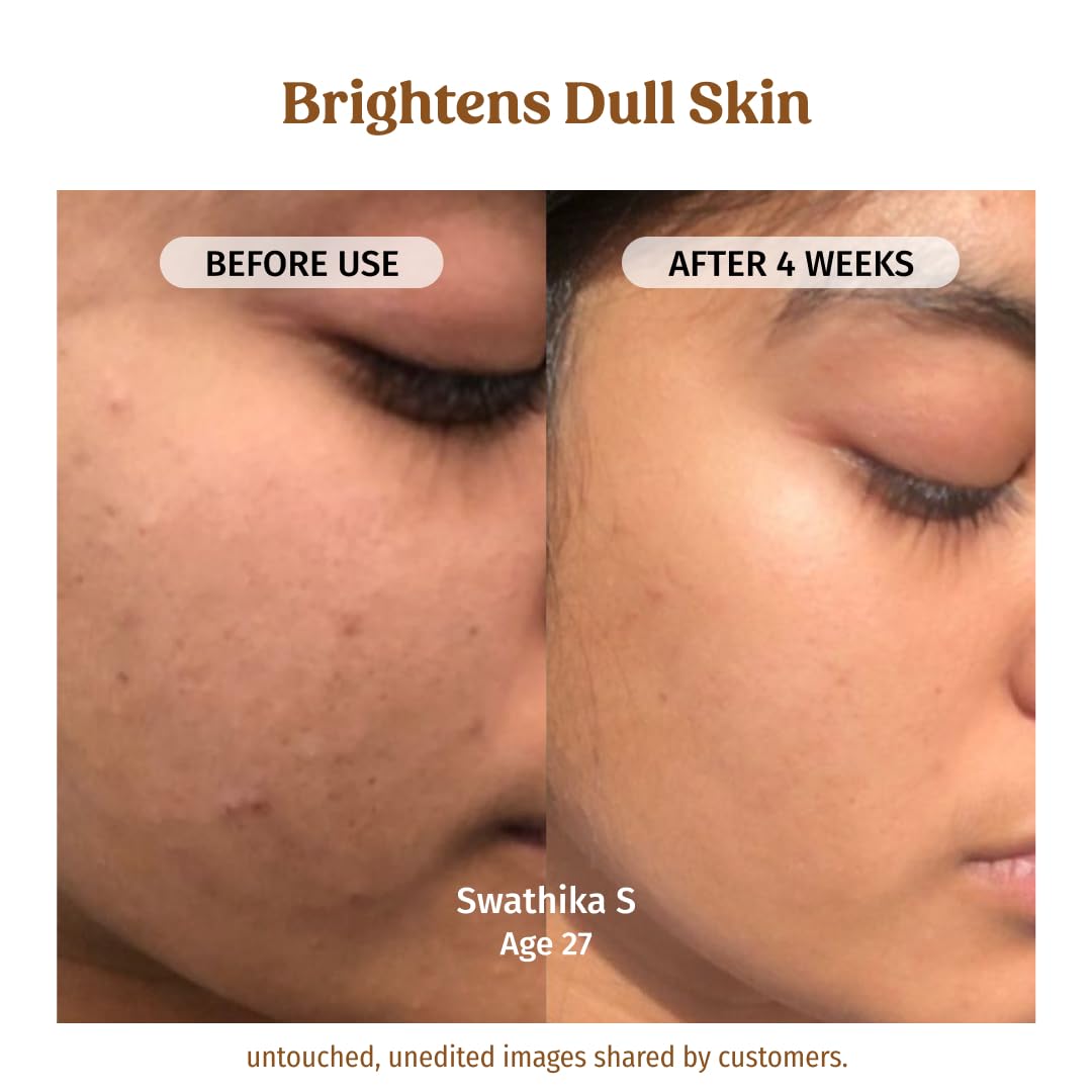 Vilvah Milk Drops Brightening Serum | Fades Dark Spots, Treats Hyperpigmentation & Evens Skin Tone | Hyaluronic Acid & Alpha Arbutin Serum for Women & Men | Suitable for All Skin Types | 20ml