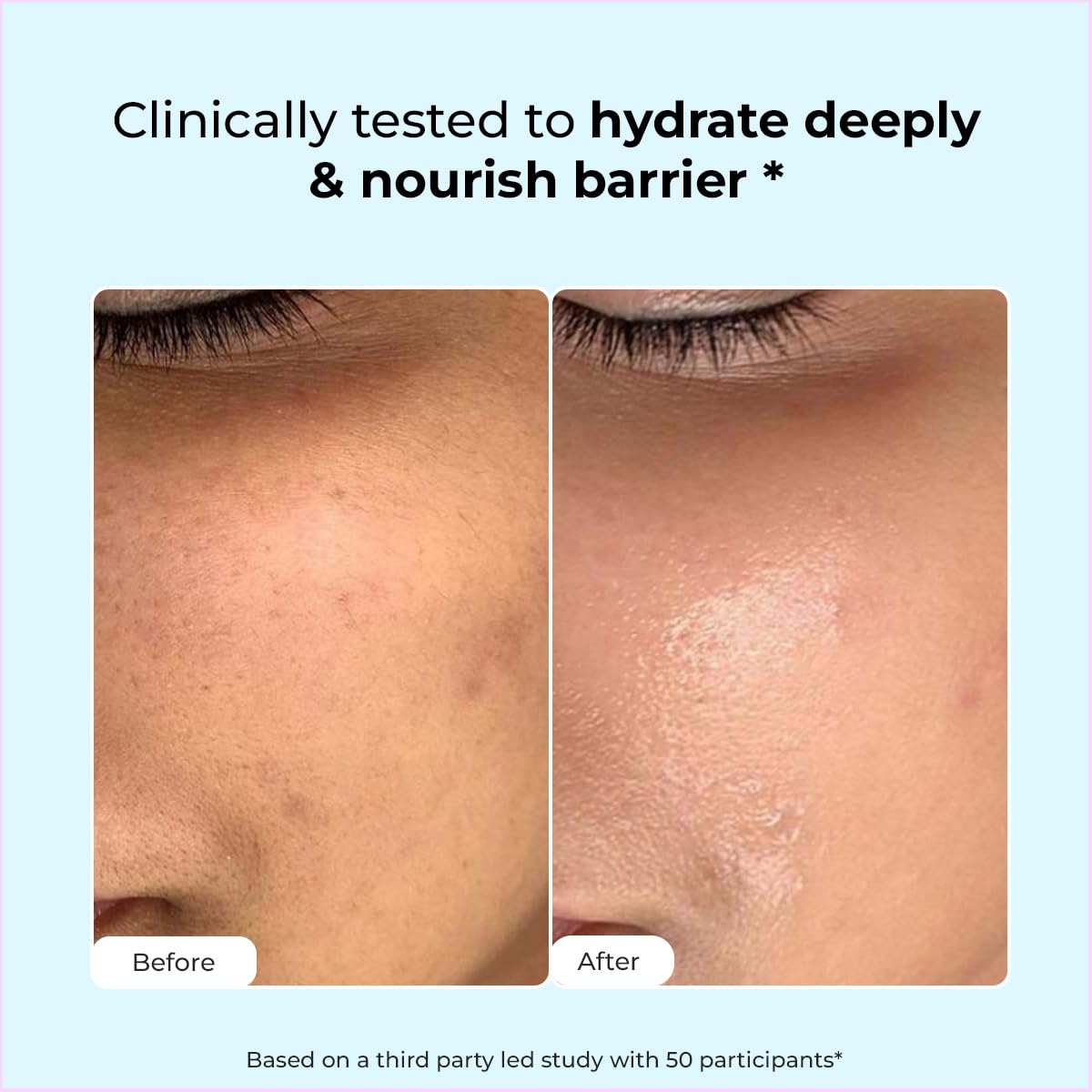 Before and after comparison of skin hydration with text indicating clinical testing.
