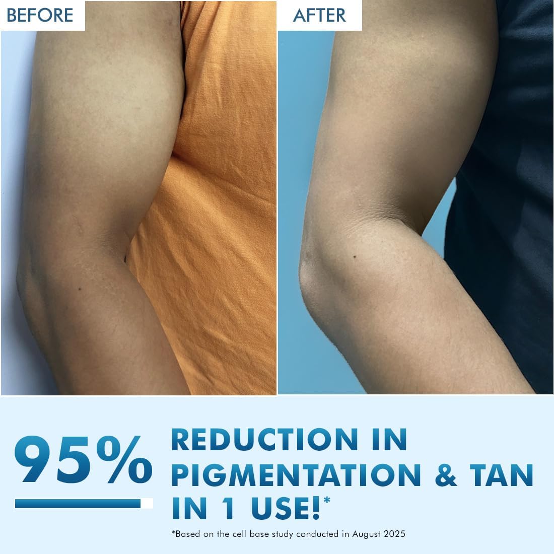 Before and after comparison of a person's arm with text claiming 95% reduction in pigmentation and tan.