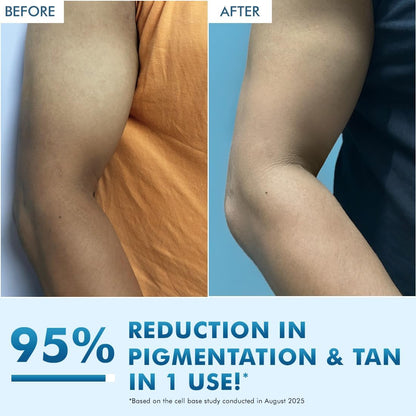 Before and after comparison of a person's arm with text claiming 95% reduction in pigmentation and tan.