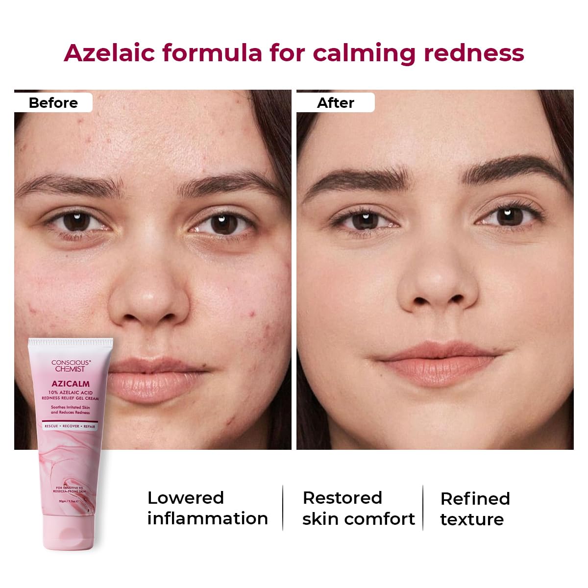 Conscious Chemist® 10% Azelaic Acid Cream | 50g | Face Cream for Men & Women, Moisturizer for Acne Prone Skin, Redness Relief, Soothe Irritation & Inflammation, All Skin Types - Azicalm