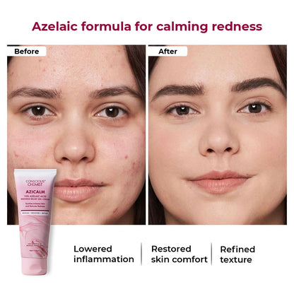 Conscious Chemist® 10% Azelaic Acid Cream | 50g | Face Cream for Men & Women, Moisturizer for Acne Prone Skin, Redness Relief, Soothe Irritation & Inflammation, All Skin Types - Azicalm