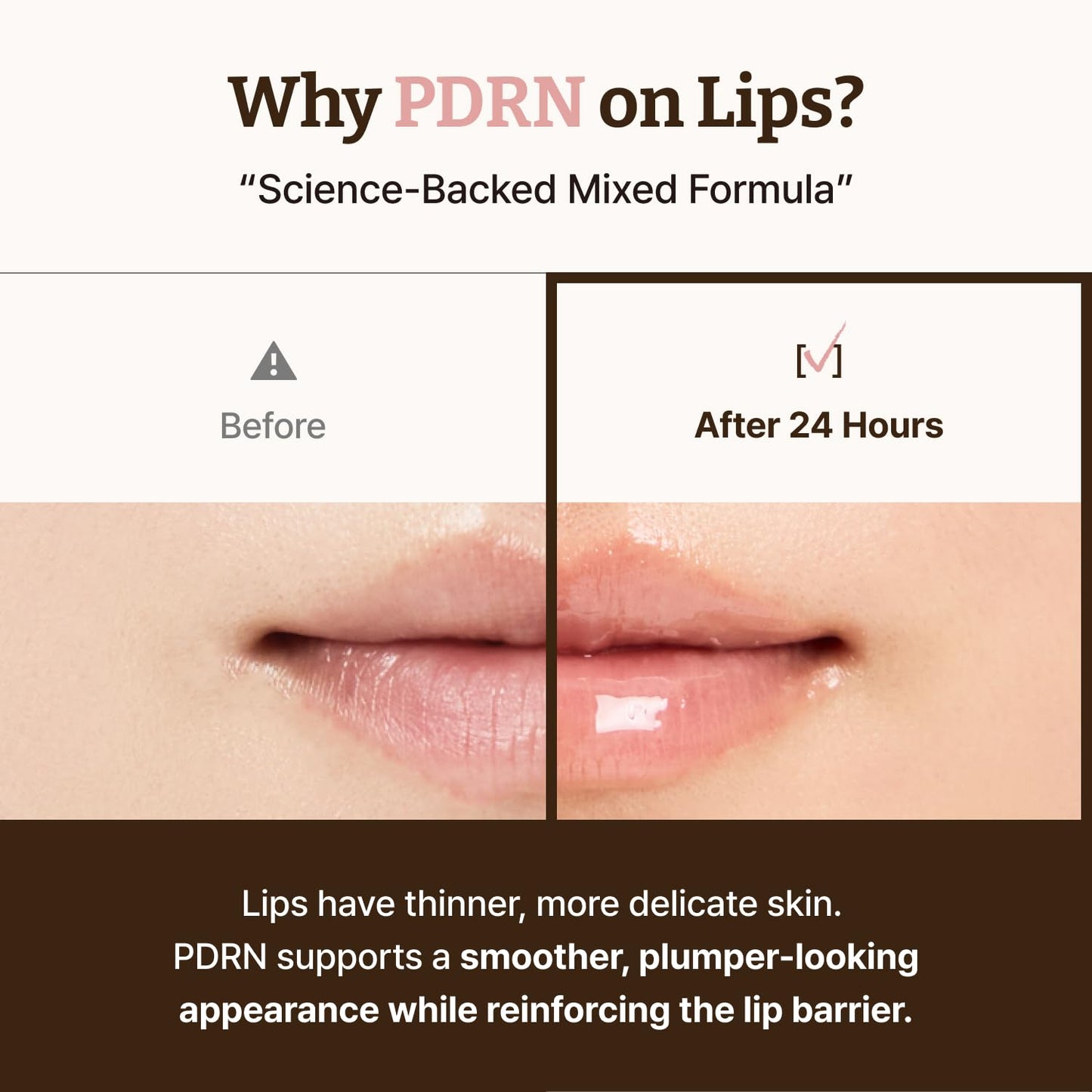Dr.Reju-All Advanced PDRN Rejuvenating Lip Serum | Hydrating Lip Balm with Lipozip PDRN for Glowy, Dewy Lips | Gentle Exfoliating & Smoothing Lip Moisturizer (10ml)