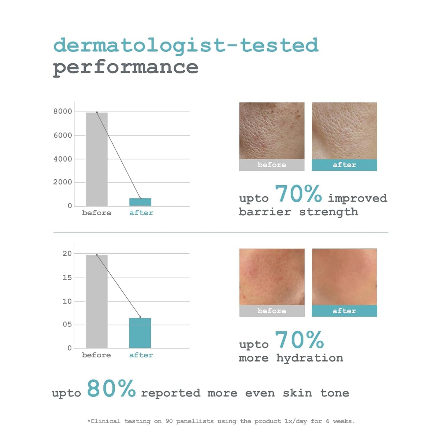 Dermacy Ceramide - 3 Barrier - Strengthening Micro Face Serum | 3 - Essential Ceramides + 2.5% Hyaluronic Acid Complex + ThermoActiv Spring Water | 30ml