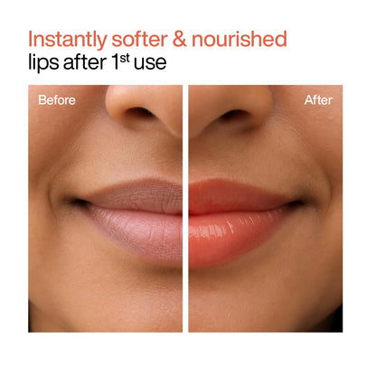 WishCare Tinted Lip Balm SPF 50 PA++++ | Brightening Lip Balm for Dark Lips | In-Vivo Tested | Kojic Acid & Niacinamide | For Women | 5g (Coral Peach)