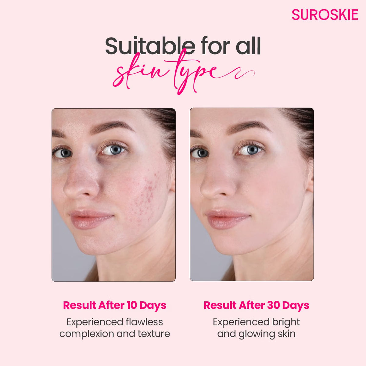 Suroskie Rose Water Elixir Face Mist 100Ml | Pure Rose Water | Face Toner For Glowing, Refresh & Hydrating Skin | Minimize Large & Open Pores | Balance Ph Of Skin | Gulab Jal For Women & Men