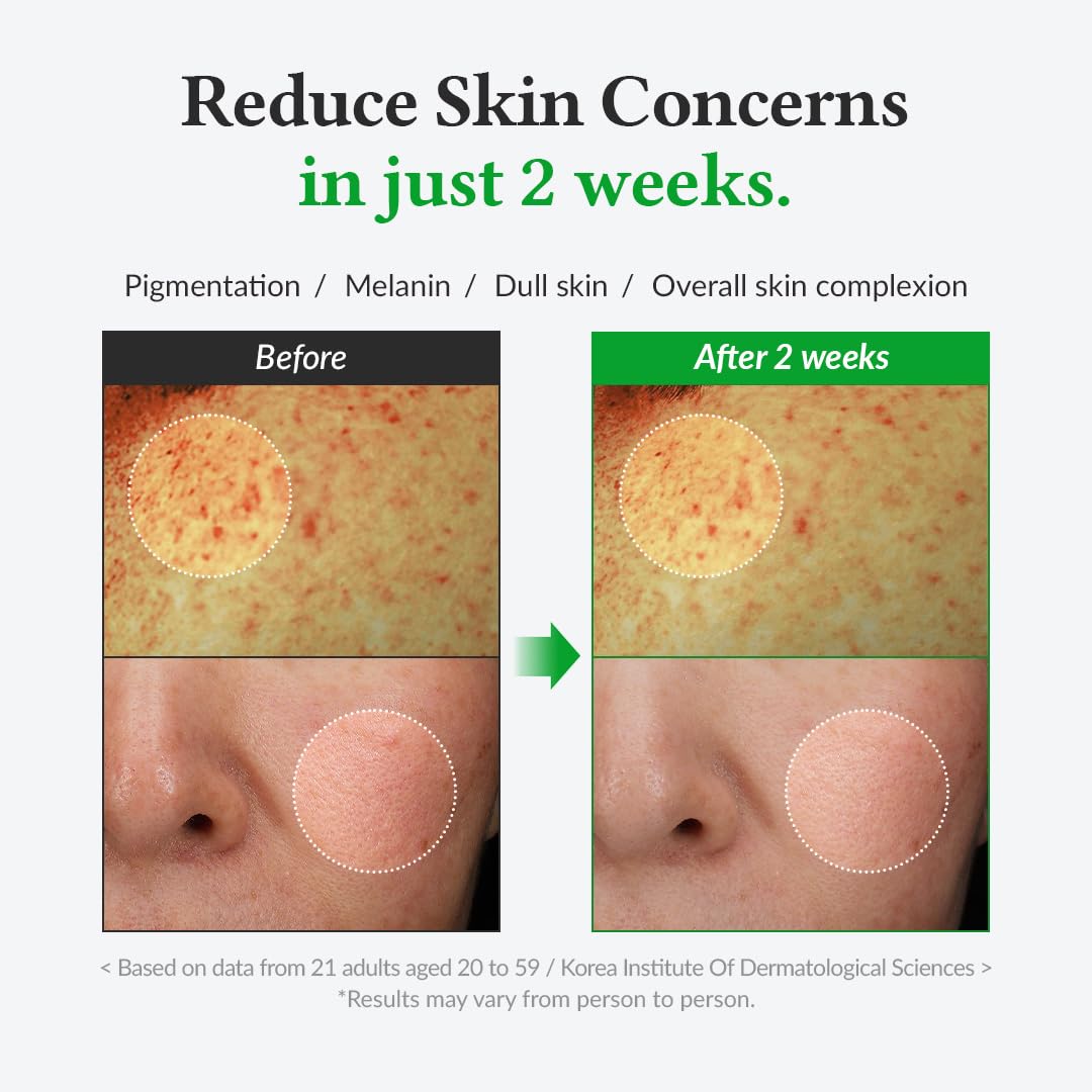 Before and after comparison of skin concerns with text indicating results in 2 weeks.