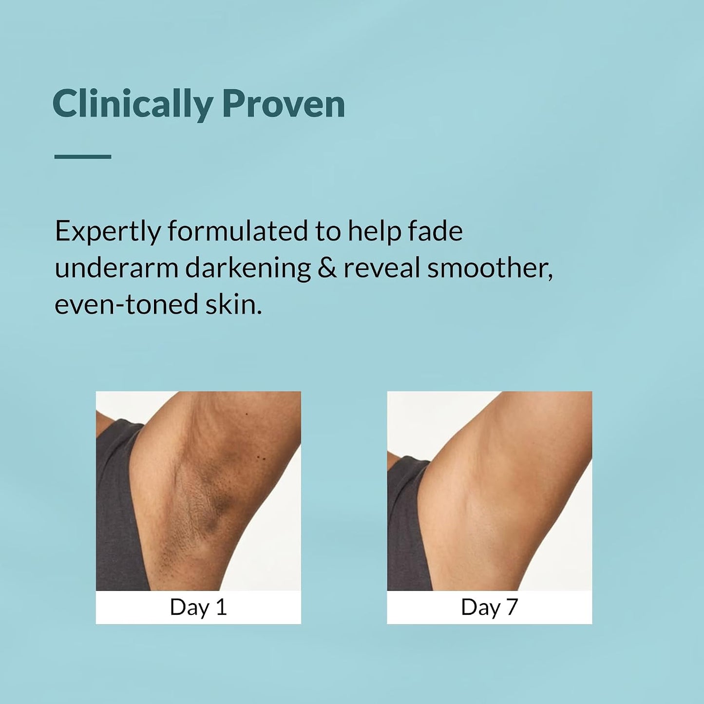 Fixderma Nigrifix Underarm Mist Spray For Dark Underarms Removal 100ml