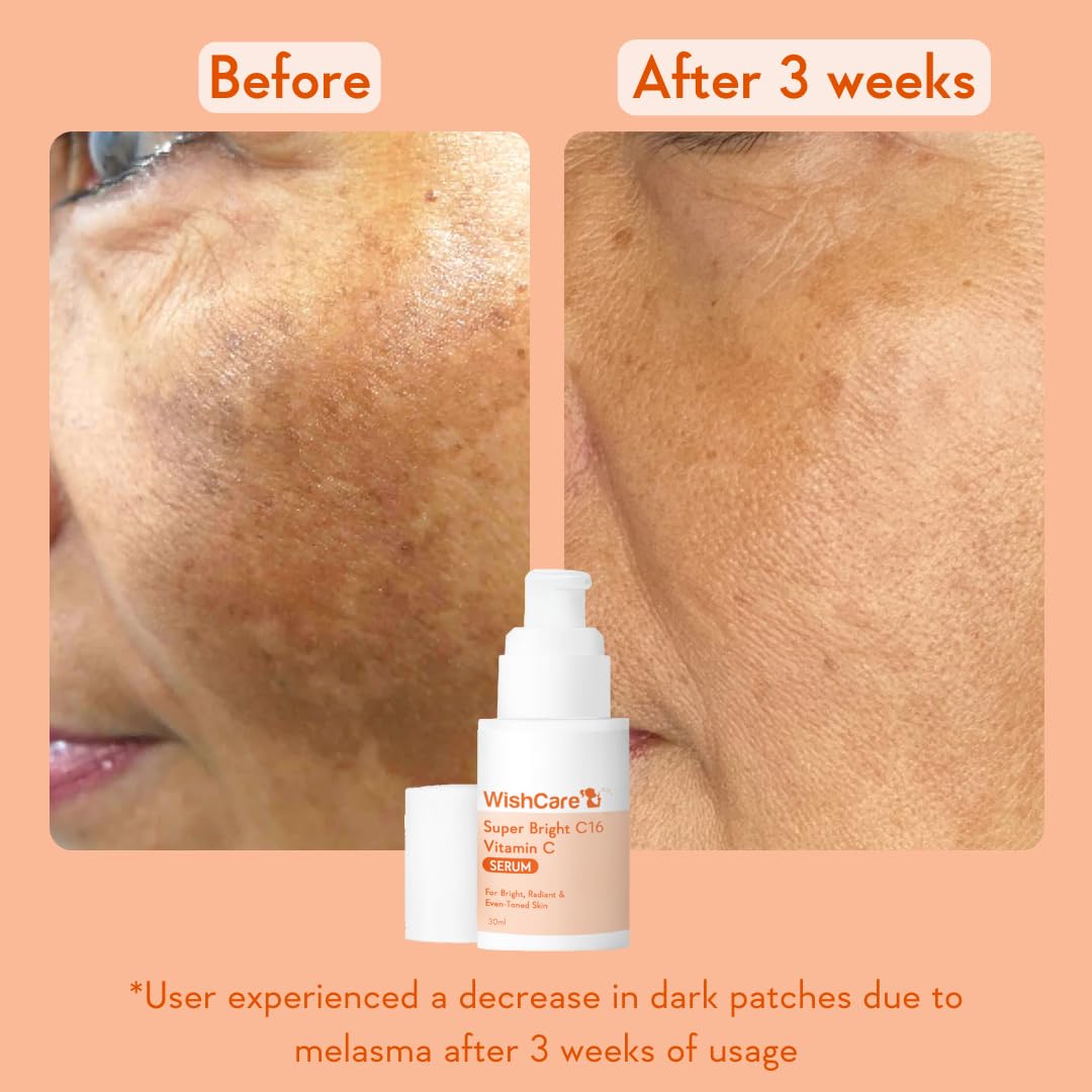 Before and after comparison of skin treatment with a bottle labeled 'WishCare' on an orange background.