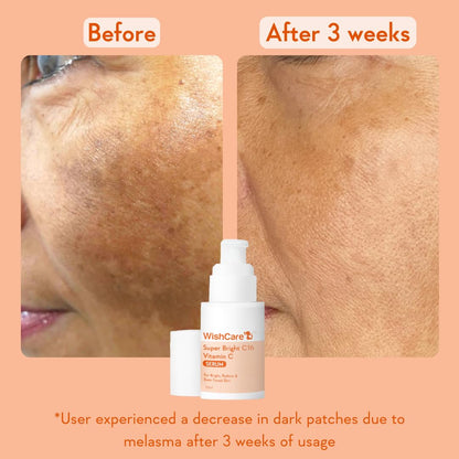 Before and after comparison of skin treatment with a bottle labeled 'WishCare' on an orange background.