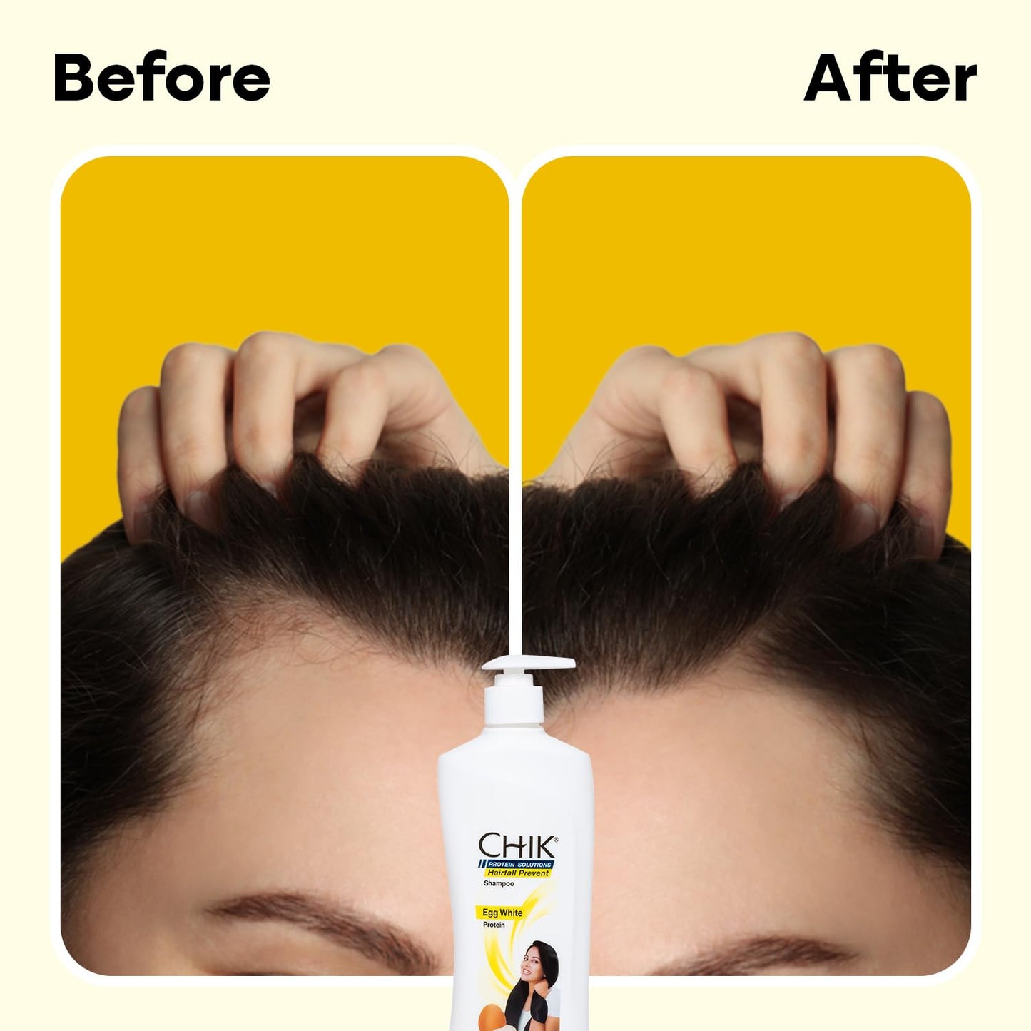 Chik Protein Solution Hairfall Prevent Shampoo, With Goodness Of Egg White, For Thick And Healthier Hair | For Men & Women | 340ml