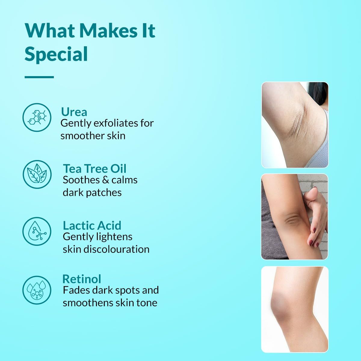 Fixderma Nigrifix Cream for Acanthosis Nigricans with Lactic Acid | Dermatologist Tested Retinol Cream | For Dark Body Parts like Neck, Ankles, Knuckles, Armpits, Thighs & Elbows | Exfoliant - 50g