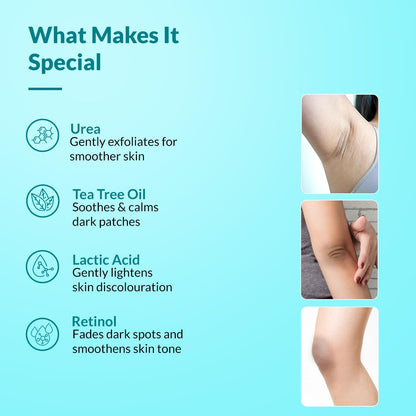 Fixderma Nigrifix Cream for Acanthosis Nigricans with Lactic Acid | Dermatologist Tested Retinol Cream | For Dark Body Parts like Neck, Ankles, Knuckles, Armpits, Thighs & Elbows | Exfoliant - 50g