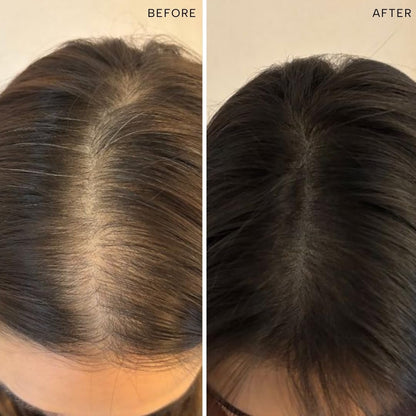 Ras Root-ine™ Hair Elixir with 30 Regenerative Botanicals
