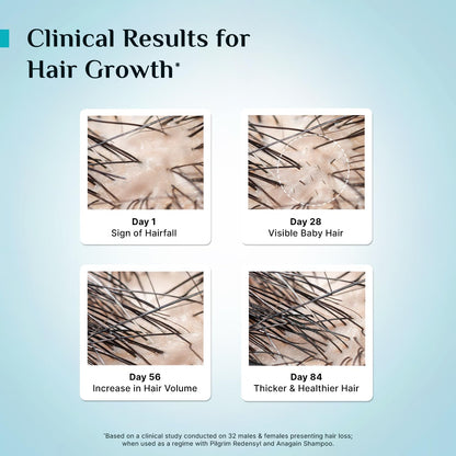 Pilgrim Redensyl 3% + Anagain 4% + 5% Capilia Stem Advanced Hair Growth Serum (30ml) for Scalp with Korean Black Rice & Rosemary | Control Hair Fall, Stimulate Hair Regrowth, Increase Hair Density
