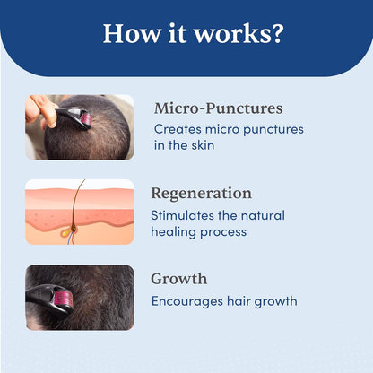 Man Matters 1.00 mm Derma Roller with Disinfectant | With 540 Titanium Alloy Needles | Promotes Beard & Hair Growth & Reduces Acne Scars | Safe & Effective to Use