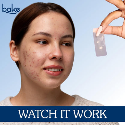 BAKE 2% Salicylic Acid Hydrocolloid Acne Absorbing (4 Patches) Surface Patch XL Pimple Patches for Blackheads Removal | Large Acne Erase Strips | Pore Cleansing & Reduces Whiteheads (10 Strips)