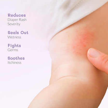 AreoVeda Diaper Rash Cream (50 gm), Suitable for newborns & babies, 15% Zinc Oxide, Prevents & Soothes Rashes from Day 1, Relieves Itchiness & Discomfort