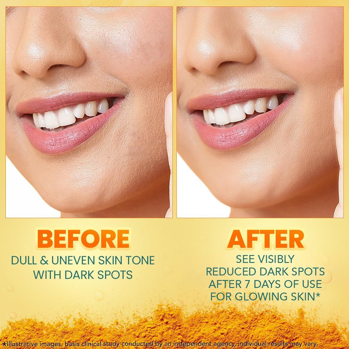 Himalaya Dark Spot Clearing Turmeric Face Serum | with 10% Glycolic Acid, 2% Niacinamide & Organically sourced Turmeric | Visibly Reduces Dark Spots from Day 7 | Clinically Tested | Non Staining | 15ml