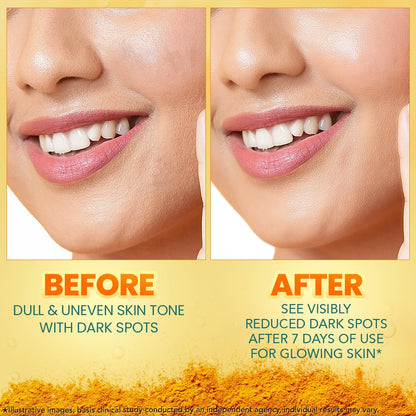 Himalaya Dark Spot Clearing Turmeric Face Serum | with 10% Glycolic Acid, 2% Niacinamide & Organically sourced Turmeric | Visibly Reduces Dark Spots from Day 7 | Clinically Tested | Non Staining | 15ml