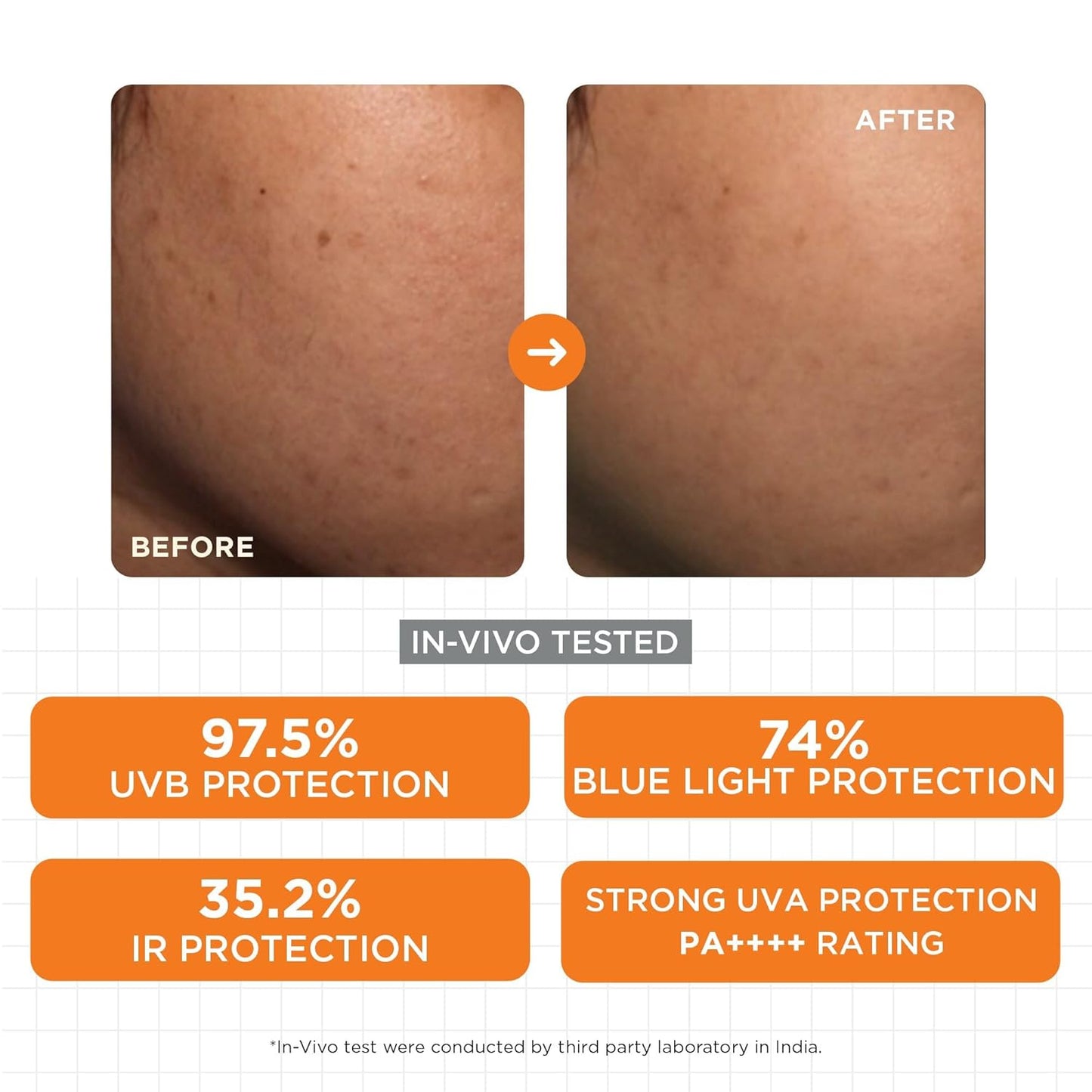 SKINQ Sun Protect Ultra Light Gel Sunscreen SPF 50+ PA++++ with Vitamin C | In-Vivo Tested | Zero White Cast | Lightweight, Non-Greasy | For Dry & Sensitive Skin | Dermat Formulated | 50ml