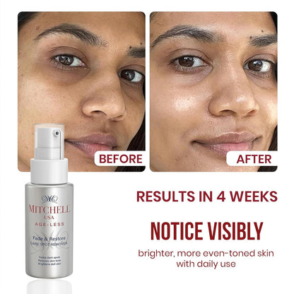 Mitchell USA Dark Spot Remover for Face | Fades Hyperpigmentation, Acne Marks & Dark Spots | Lotus Seed Extract, Pomegranate oil & Vitamin C | For Oily, Dry & Sensitive Skin of Men & Women | 50ml