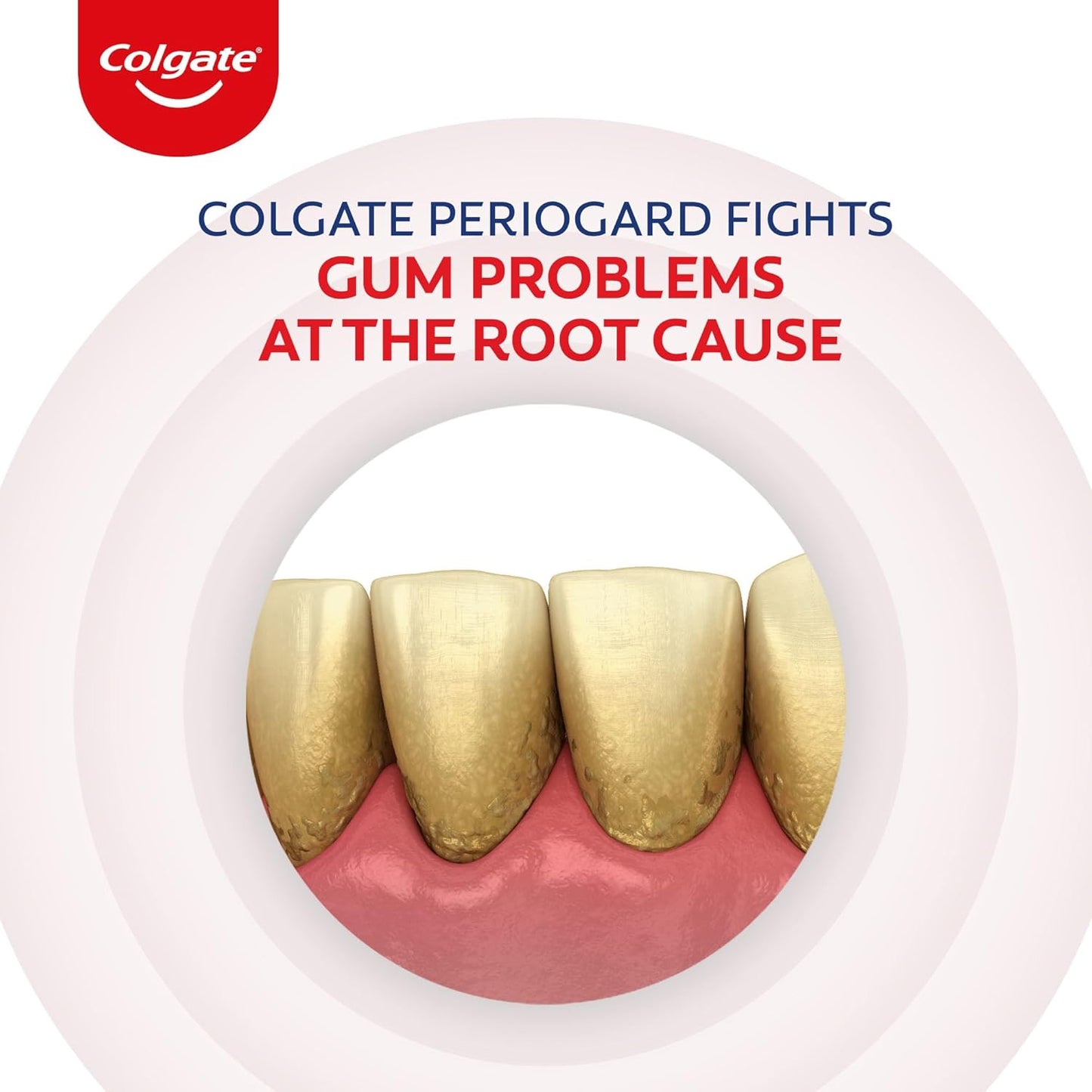 Colgate PerioGard Toothpaste 90g, Specialized Gum Care System, Fights Gum Problems