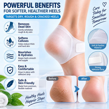 KYTRONIC Exfoliating Heel Mask for Dry, Rough & Cracked Heels, 1 Pair Heel care mask with moisturizing essence for dry, rough skin, dead skin and callus care; easy adhesive fit, 1 pair