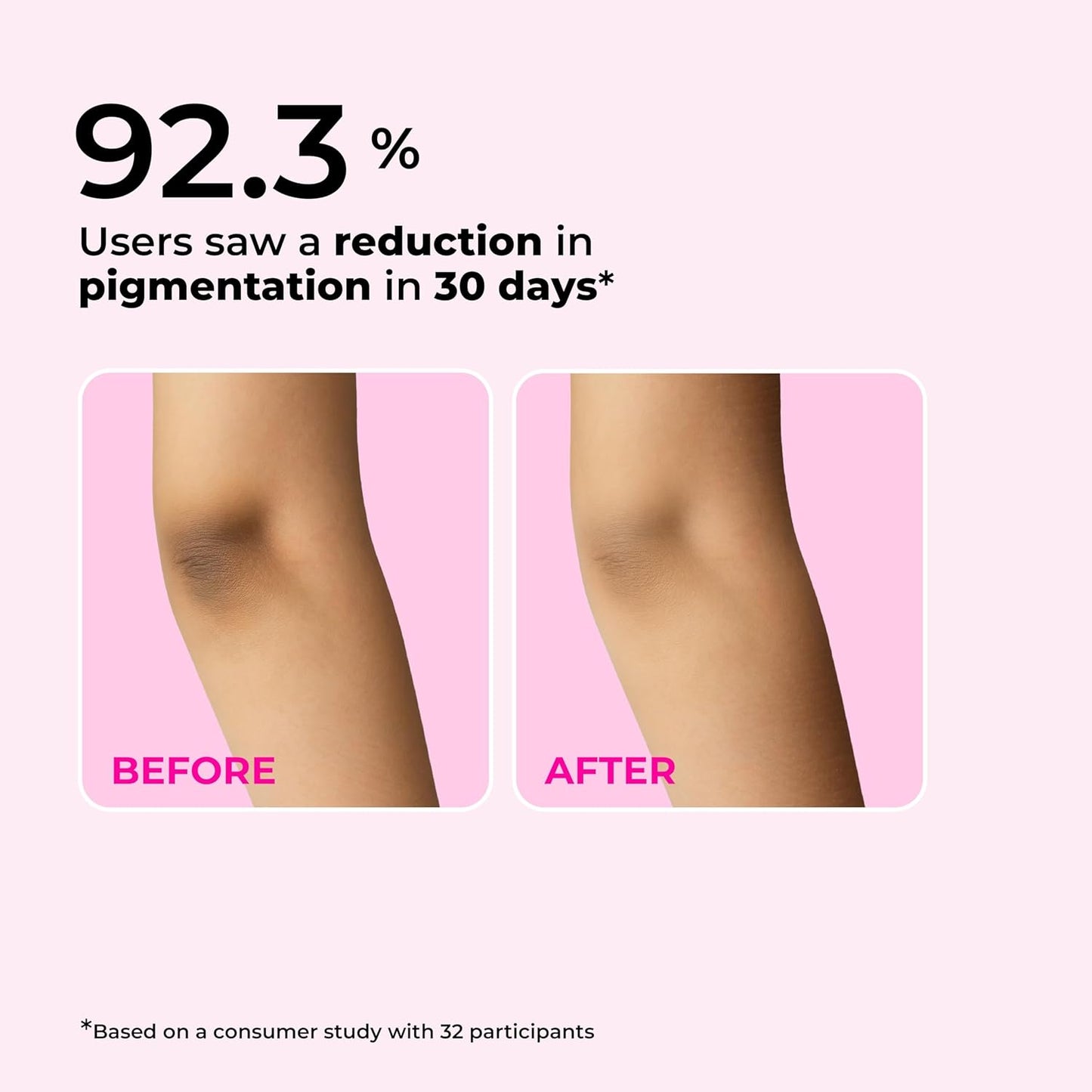 FoxTale Hula Hoop Brightening Body Lotion by Foxtale| Niacinamide + Kojic Acid + SPF30 | Moisturizes, Brightens, & Even Tones Skin | Prevents Tanning & Sun Damage | Light & Grease-Free | 200ml