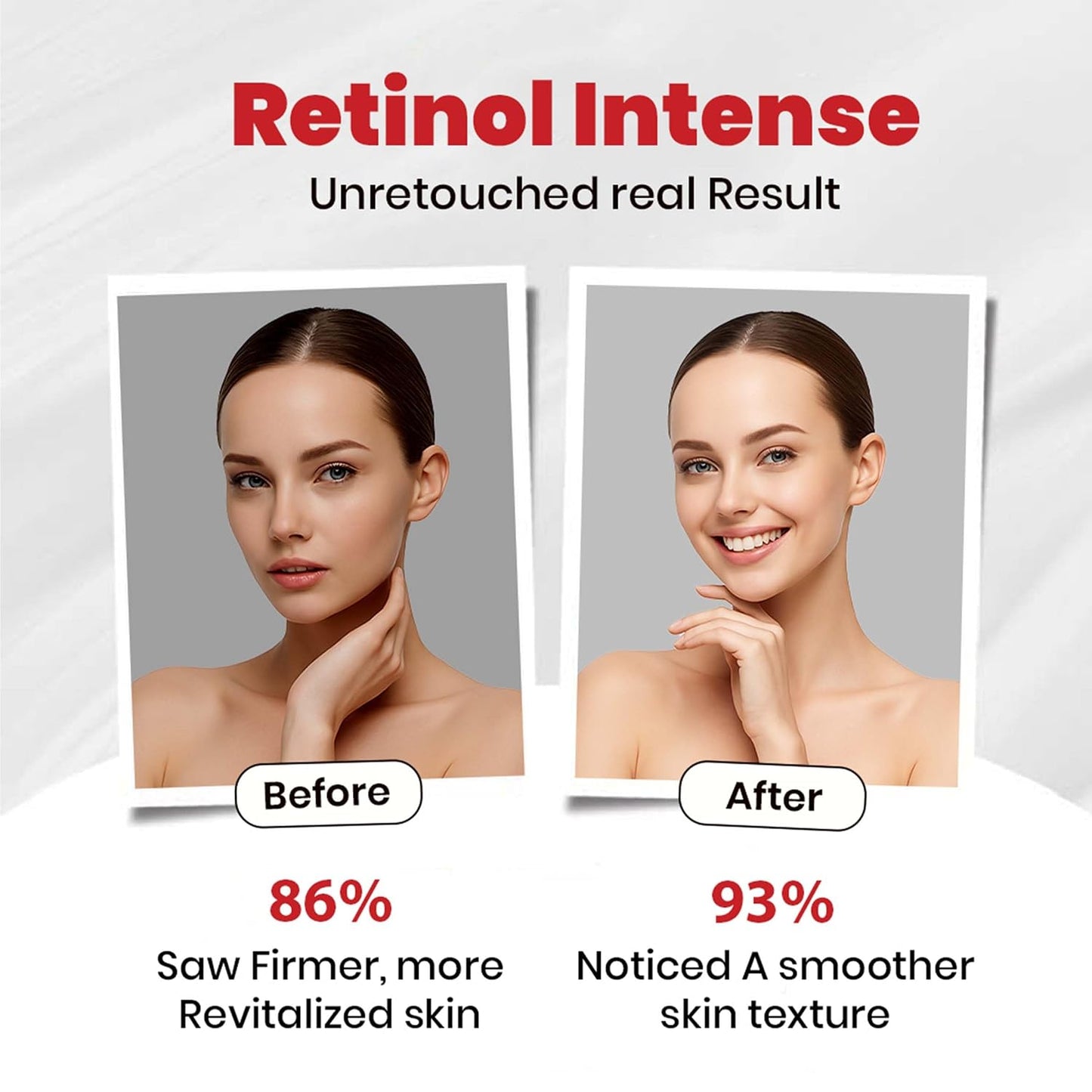 Retinol Intense Cream 0.1 Vitamin A Fine Lines, Sun Spots, Anti-Aging (40 Gram / 1.41 Oz)
