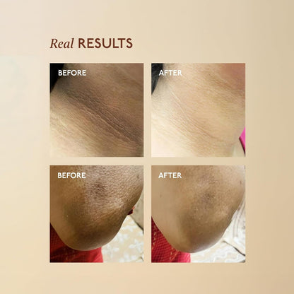 Before and after comparison of hair removal on a beige background with 'Real Results' text.