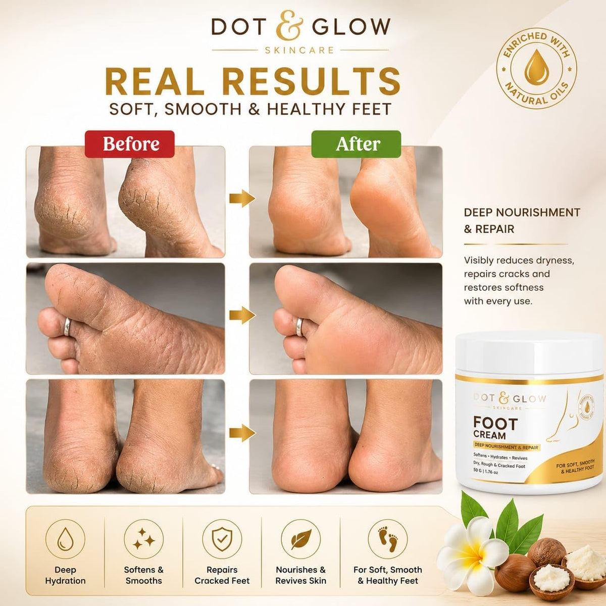 Dot & Glow Moisturizing Foot Cream 50g | Shea Butter, Aloe Vera & Vitamin E with Natural Oils | Hydrating Foot Care Cream for Dry, Rough & Cracked Feet | Men & Women